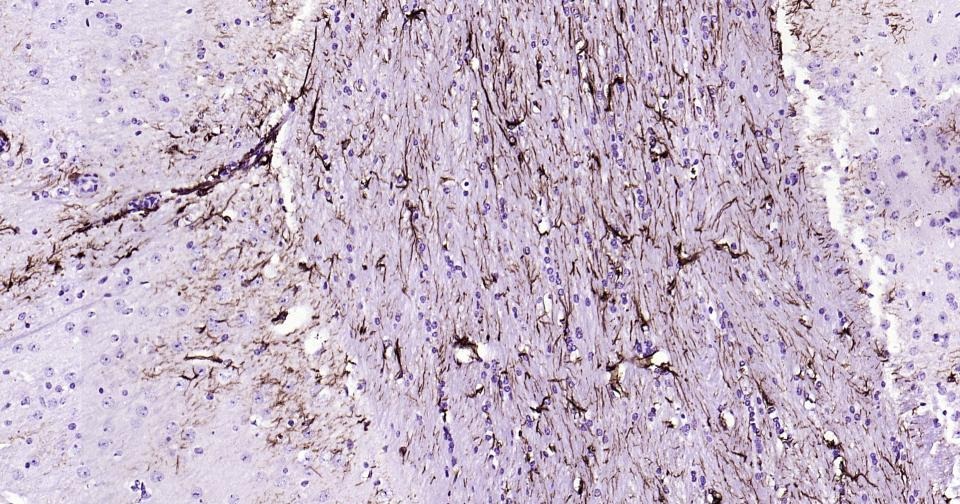 Anti-GFAP Antibody (3A643)