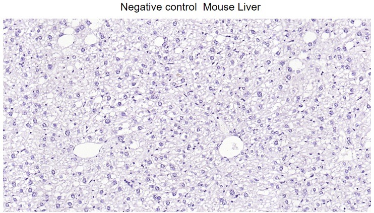 Anti-GFAP Antibody (3A643)