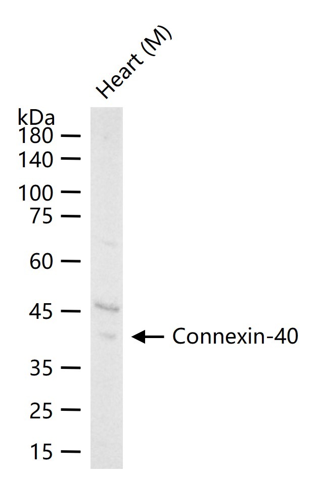 Anti-GJA5 Polyclonal Antibody