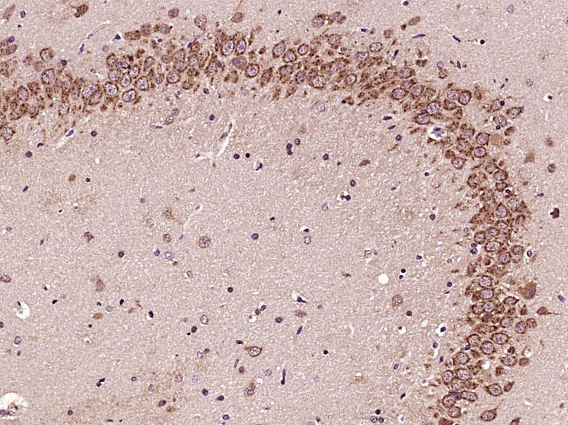 Anti-GLI1 Polyclonal Antibody