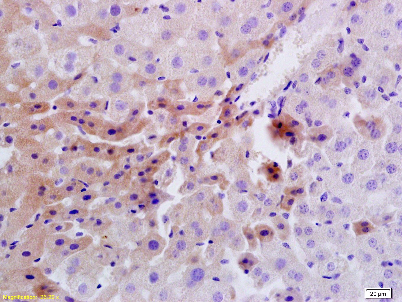 Anti-Insulin Receptor Polyclonal Antibody