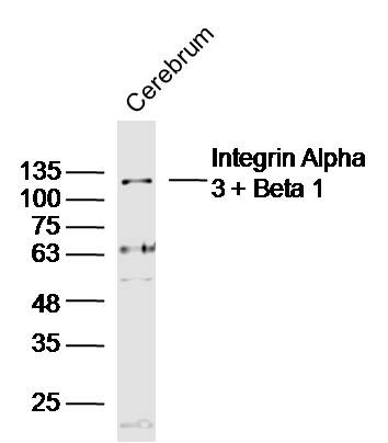 Anti-Integrin  alpha 3  beta 1 Polyclonal Antibody