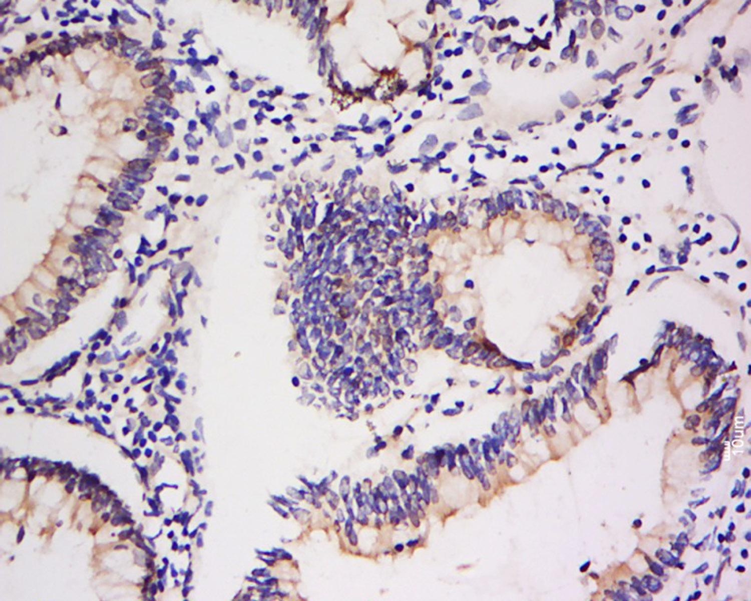 Anti-Integrin  alpha 5  beta 5 Polyclonal Antibody
