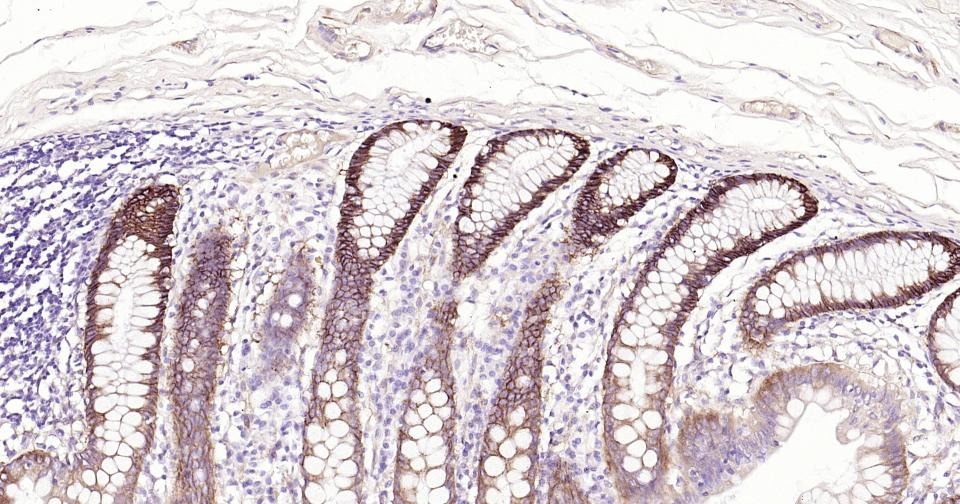 Anti-Integrin alpha 2 Antibody (8P138)