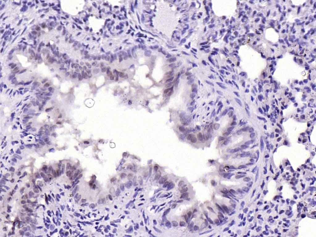 Anti-JAK2 Polyclonal Antibody