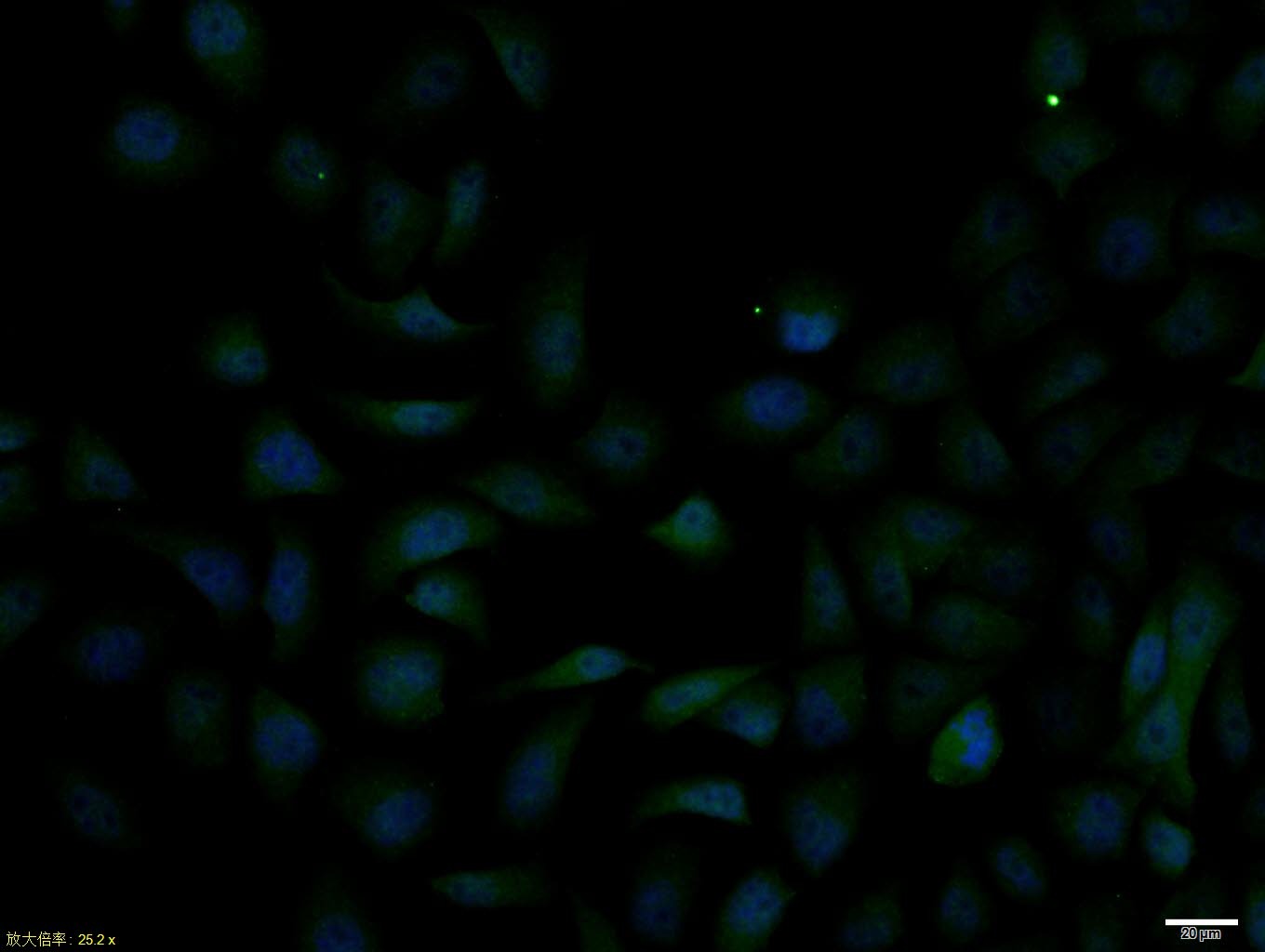 Anti-JAK2 Polyclonal Antibody 2