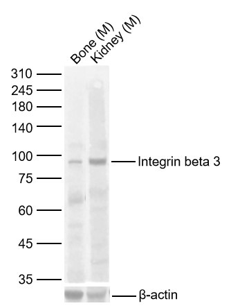Anti-ITGB3 Polyclonal Antibody