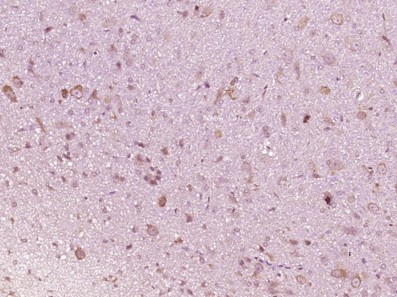 Anti-IFNAR1 Polyclonal Antibody