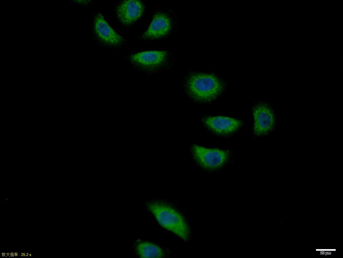 Anti-Jagged 1 Polyclonal Antibody