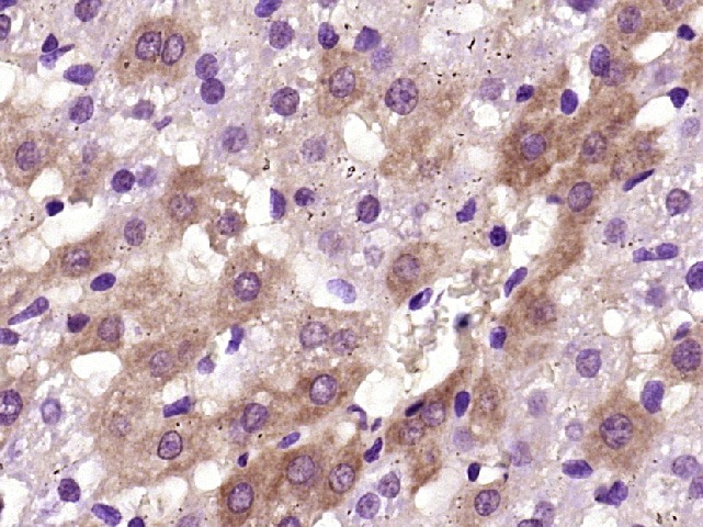 Anti-ITGB1 Polyclonal Antibody