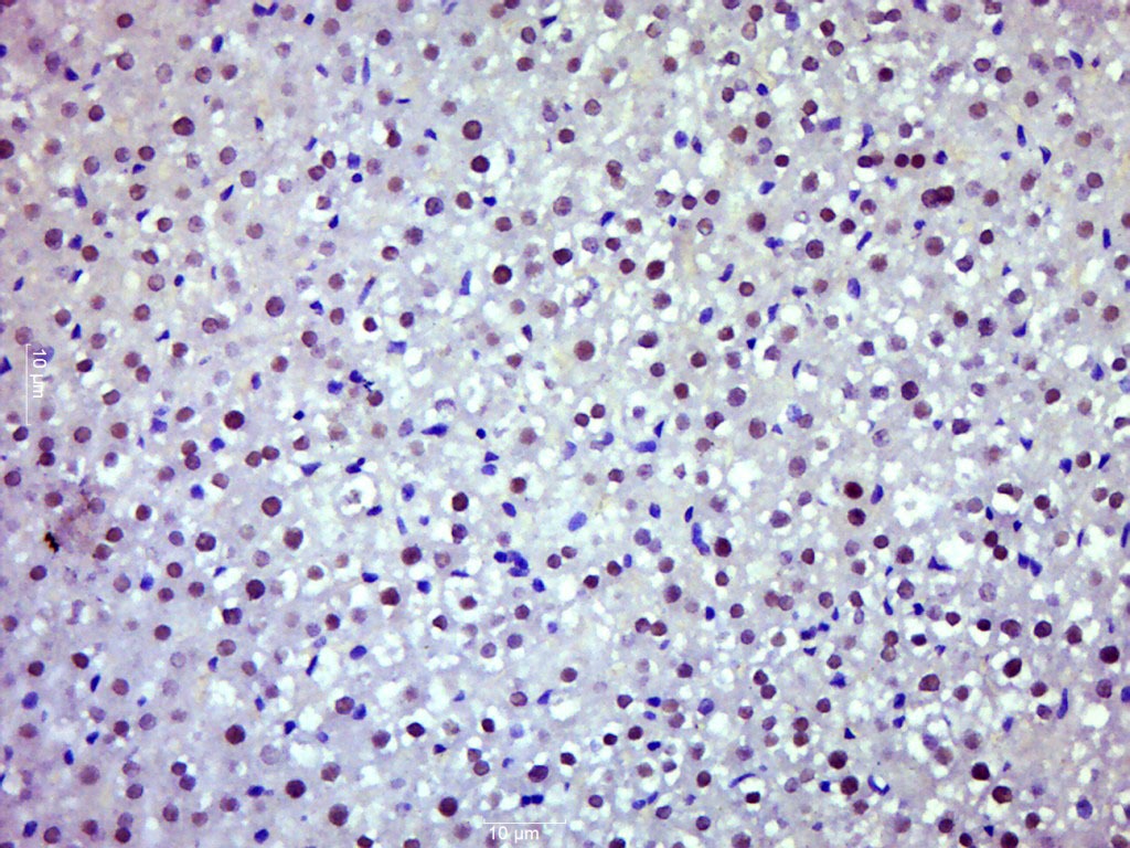 Anti-JAK2 Polyclonal Antibody