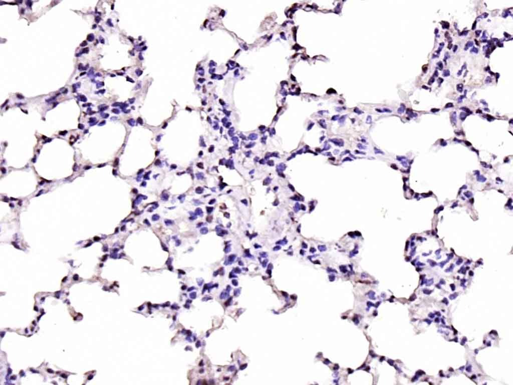 Anti-JAK2 Polyclonal Antibody