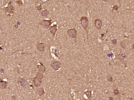 Anti-IFN-alpha 2b/IFNA2 Polyclonal Antibody