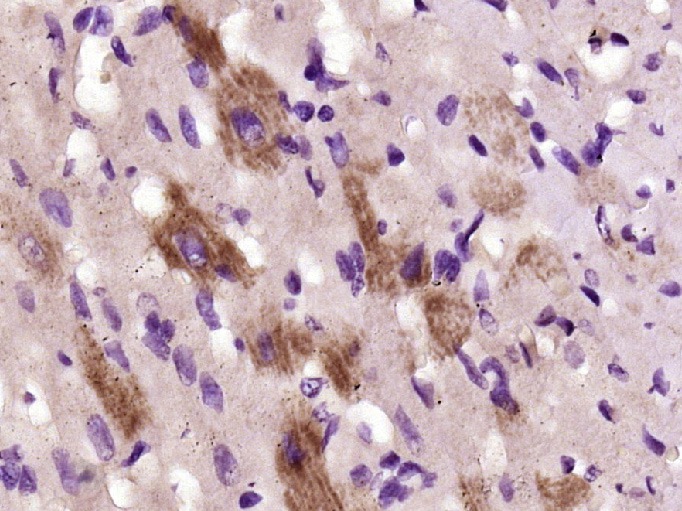 Anti-ITGB1 Polyclonal Antibody