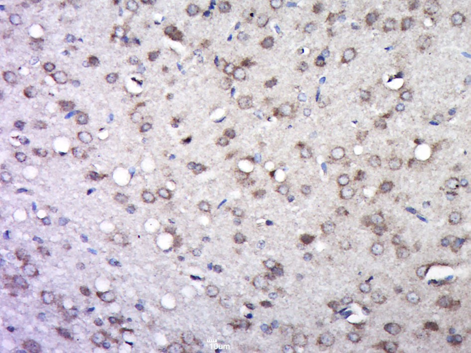 Anti-ITGB1 Polyclonal Antibody