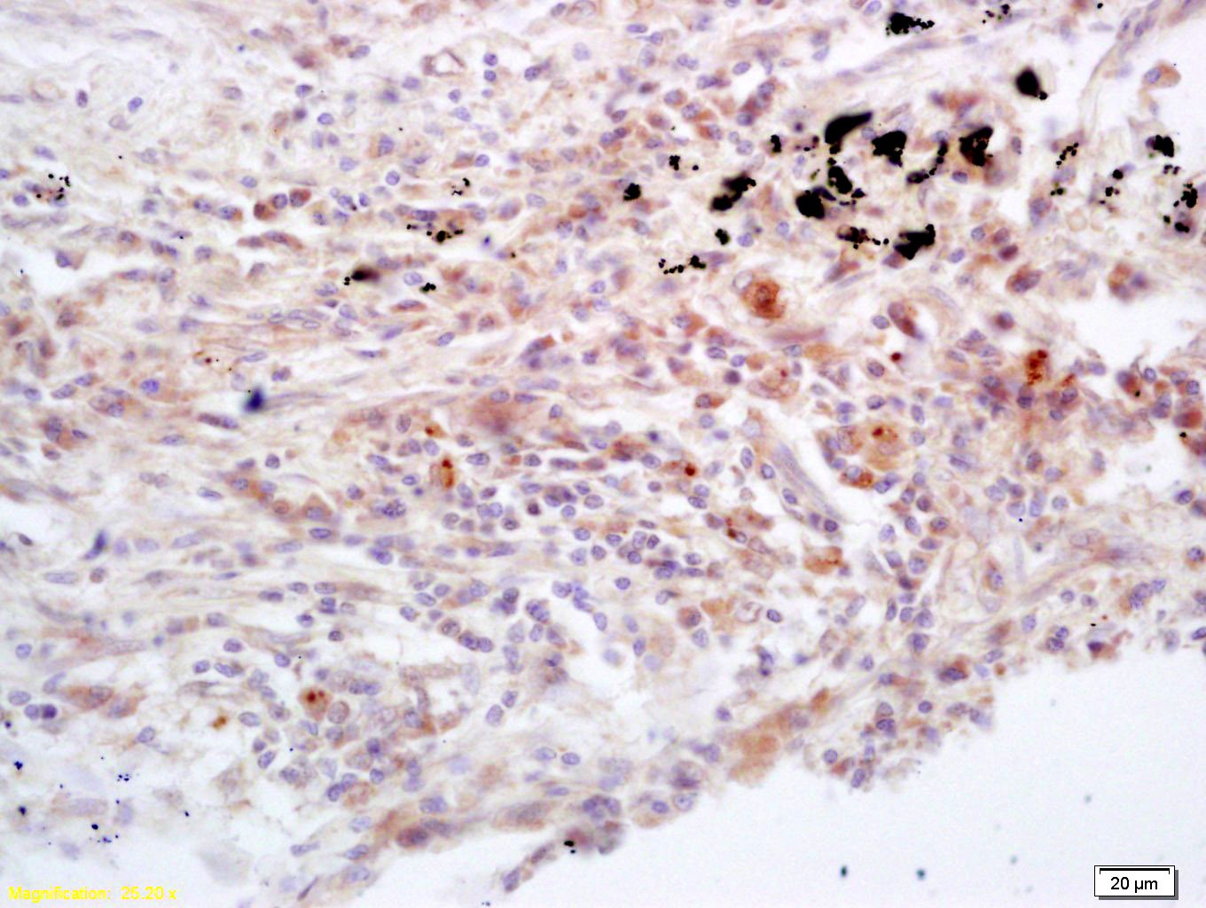 Anti-JAK3 Polyclonal Antibody