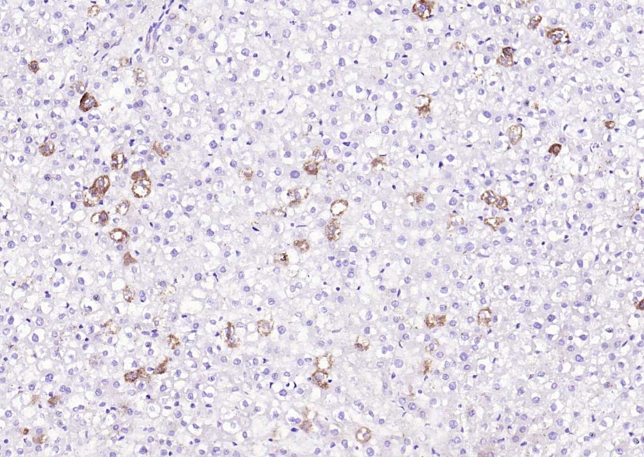 Anti-IKBKA Polyclonal Antibody