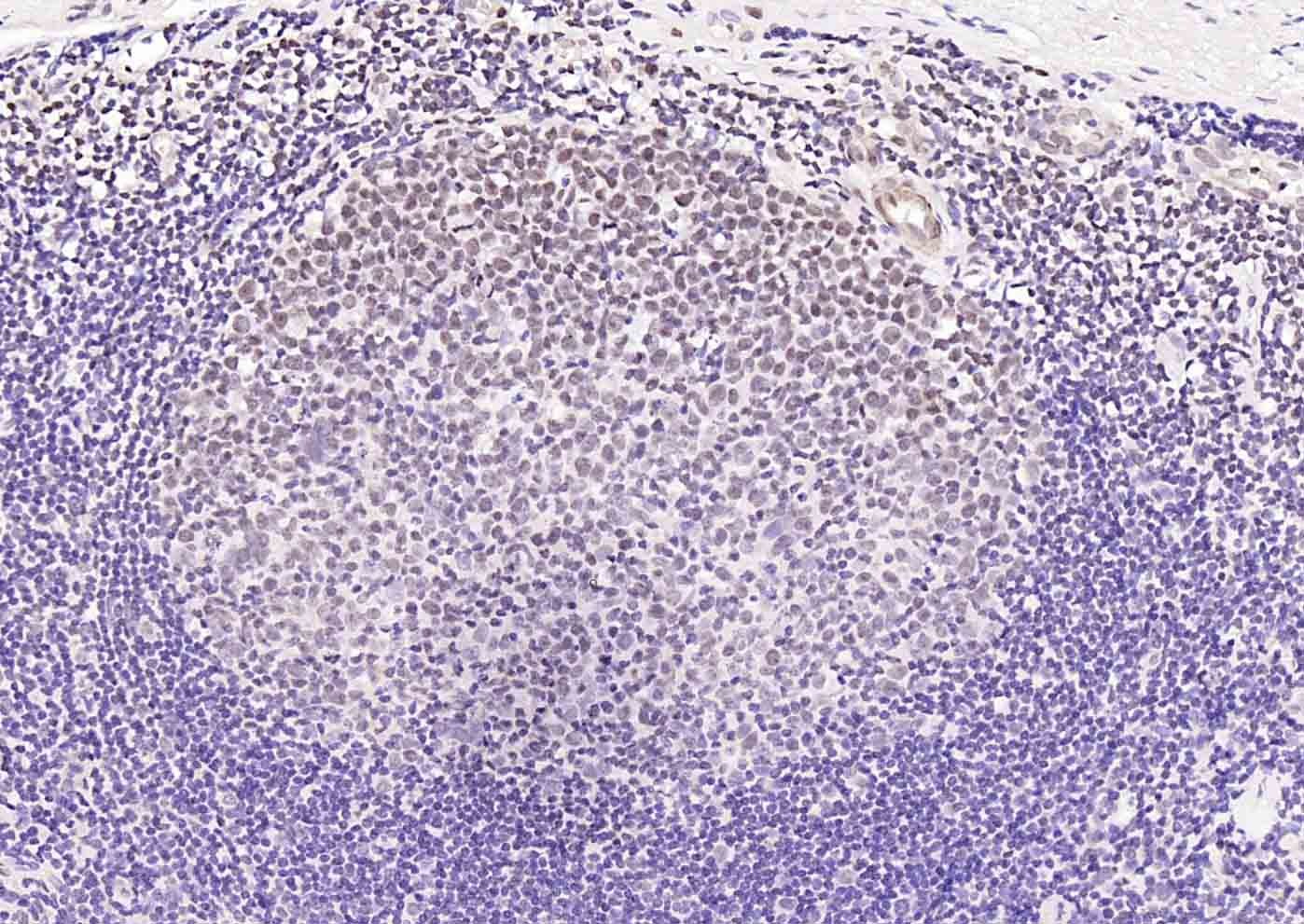Anti-IGF2BP1 Polyclonal Antibody