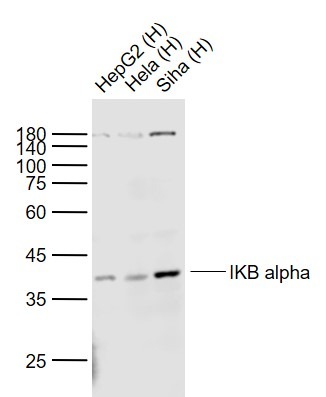 Anti-IkB alpha/NFKBIA Antibody (5M346)