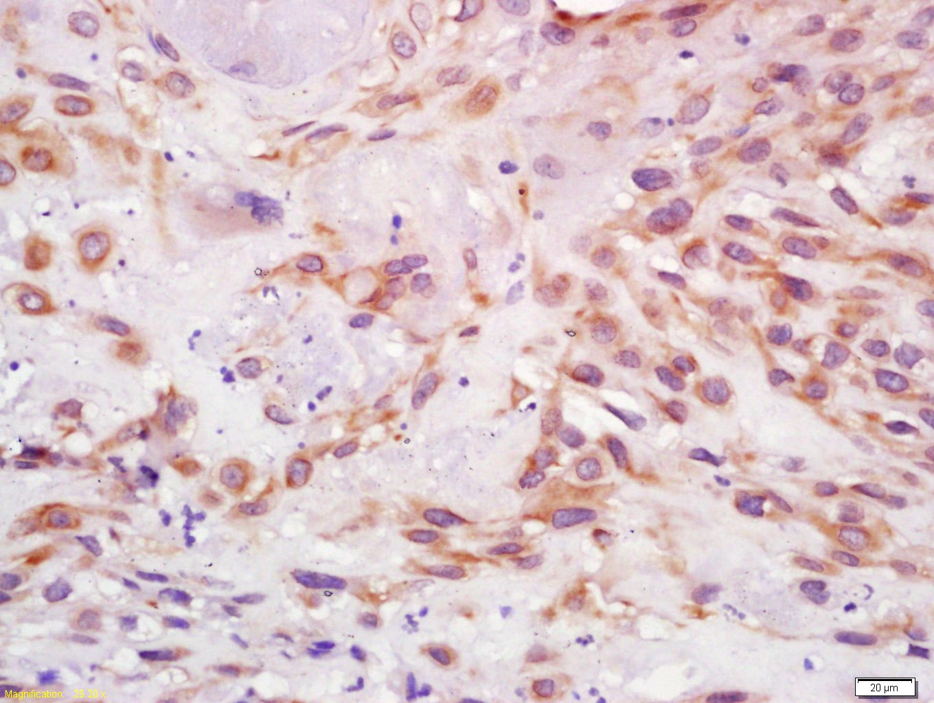 Anti-IGF1/IGF-I Polyclonal Antibody 2
