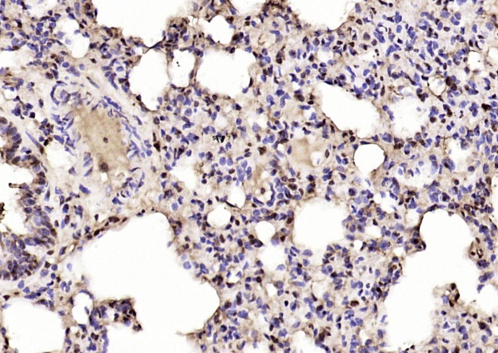Anti-IGF2BP1 Polyclonal Antibody