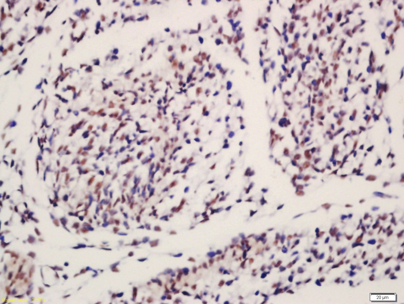 Anti-IGF2BP1 Polyclonal Antibody