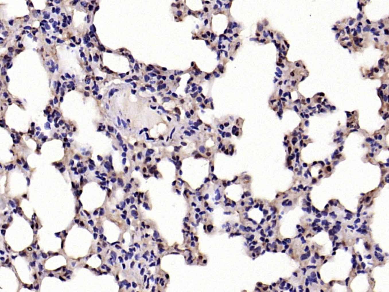 Anti-IkB alpha/NFKBIA Polyclonal Antibody
