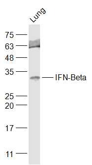 Anti-IFN-beta Polyclonal Antibody 2