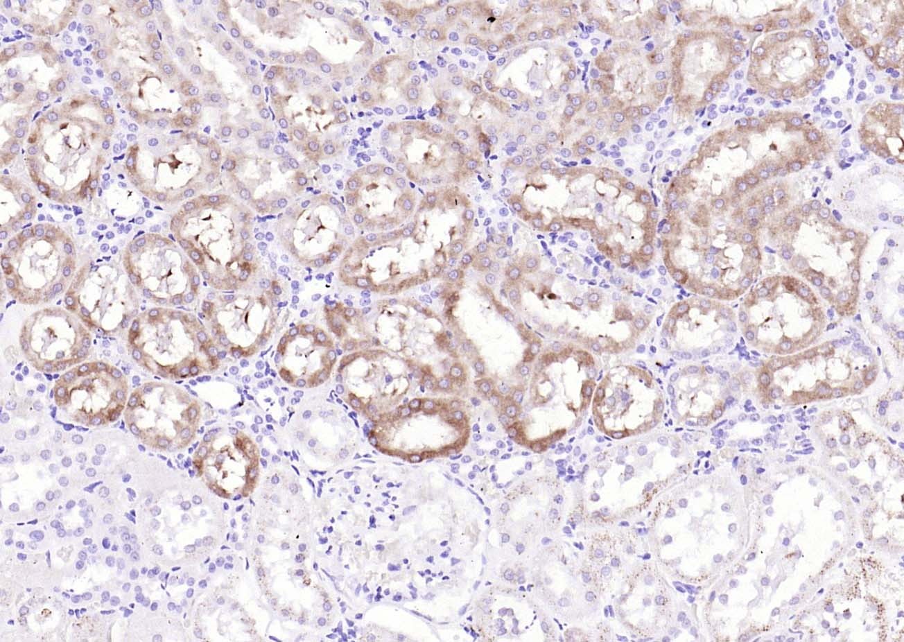 Anti-IKBKA Polyclonal Antibody