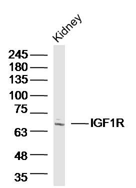 Anti-IGF1R/CD221 Polyclonal Antibody 2