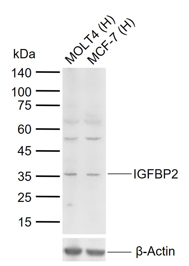 Anti-IGFBP2 Polyclonal Antibody