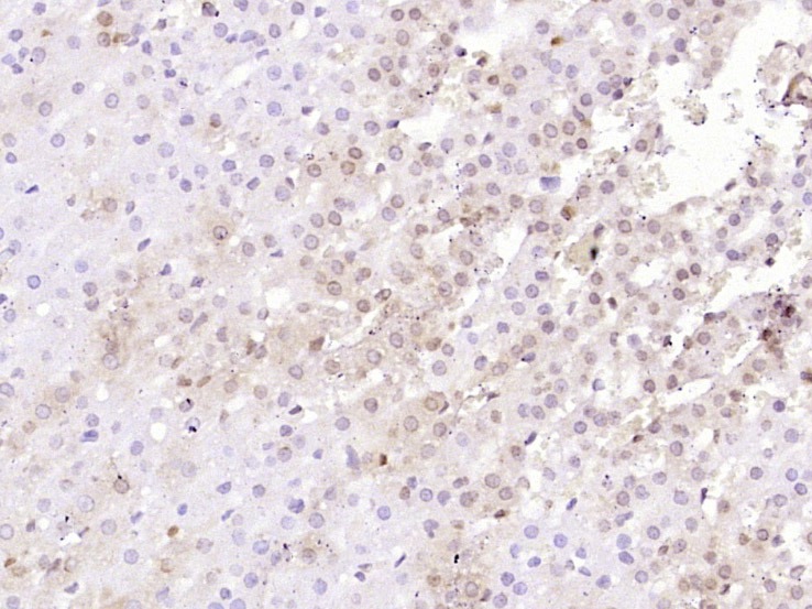 Anti-IkB alpha/NFKBIA Antibody (5M346)