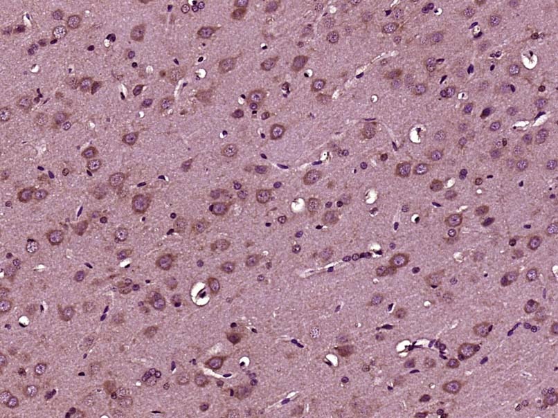 Anti-IGF1/IGF-I Polyclonal Antibody