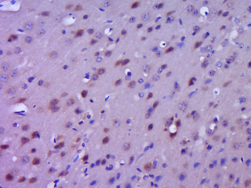 Anti-IkB alpha/NFKBIA Polyclonal Antibody