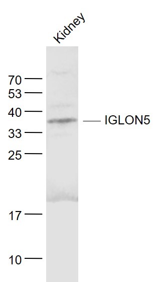 Anti-IGLON5 Polyclonal Antibody