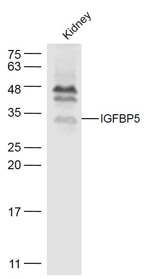 Anti-IGFBP-5 Polyclonal Antibody