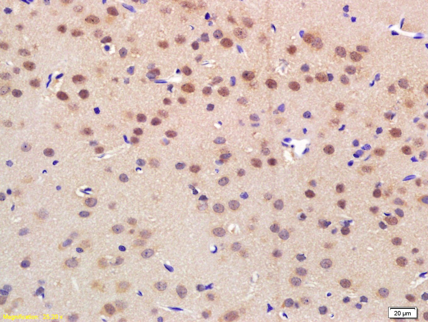 Anti-NRF1 Polyclonal Antibody