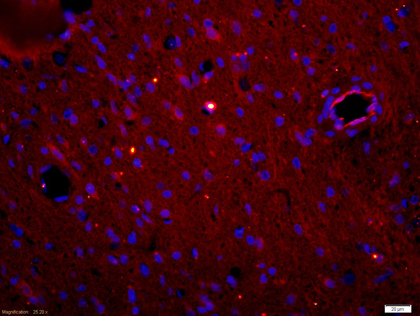 Anti-MPO Polyclonal Antibody 2