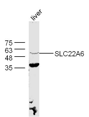 Anti-OAT-1 Polyclonal Antibody