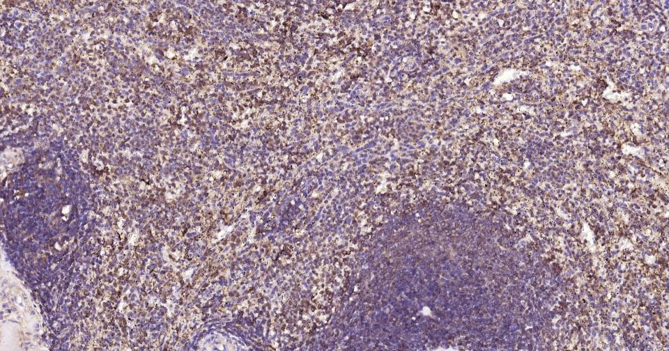 Anti-MRC1 Antibody (6S133)