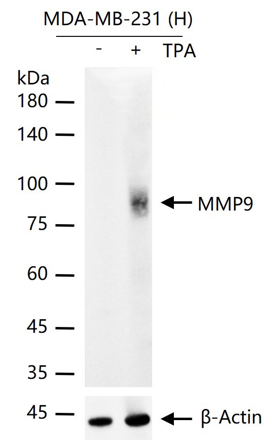 Anti-MMP-9 Antibody (3R987)