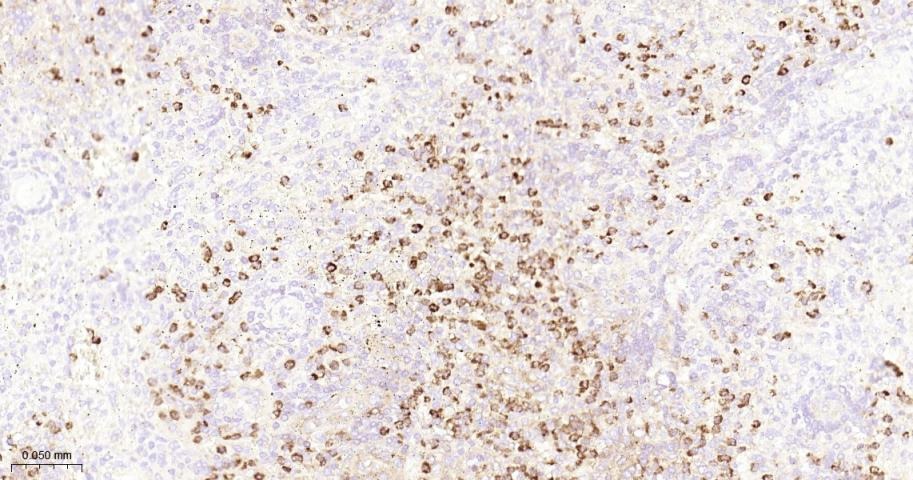 Anti-MMP-9 Antibody (3R987)