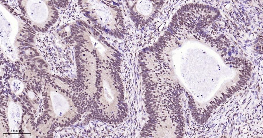 Anti-NUMA1 Antibody (6H53)