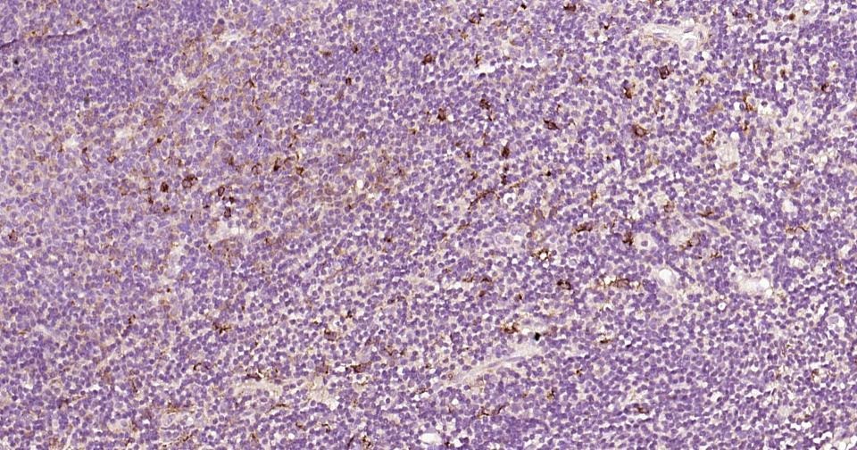 Anti-MMP-9 Polyclonal Antibody 3