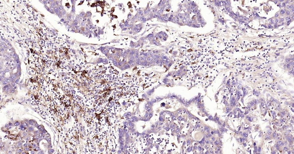 Anti-MMP-9 Antibody (3R987)