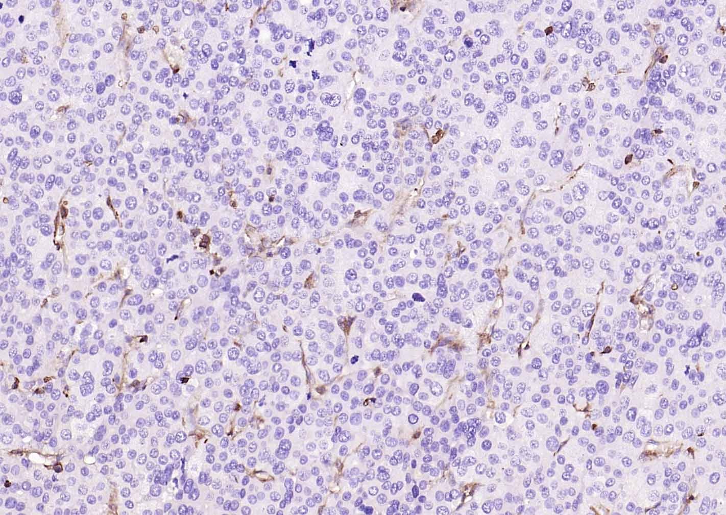 Anti-MRC1 Antibody (6S133)