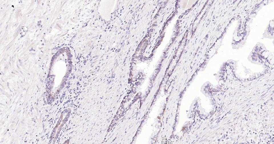 Anti-MMP-7 Polyclonal Antibody