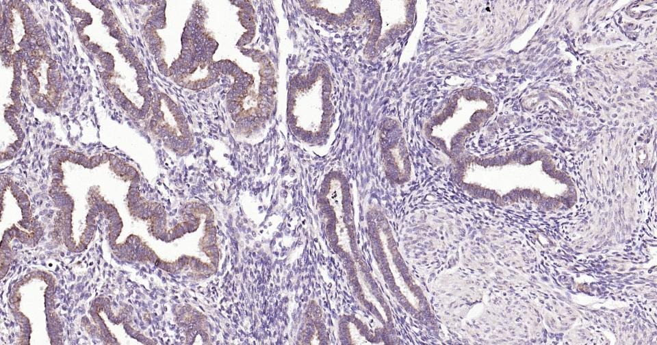 Anti-MMP-7 Polyclonal Antibody