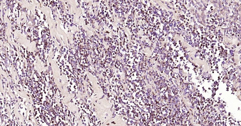 Anti-MMP-9 Polyclonal Antibody 3