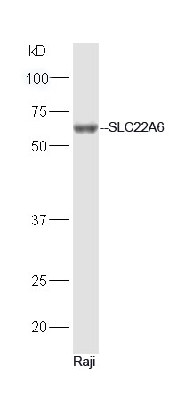 Anti-OAT-1 Polyclonal Antibody